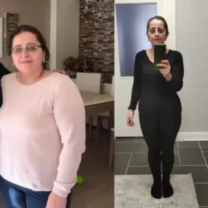 obezite cerrahisi deegisim sanati12