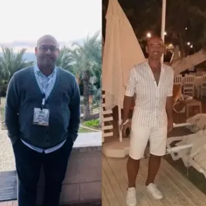 obezite cerrahisi deegisim sanati15