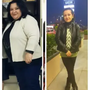 obezite cerrahisi deegisim sanati17