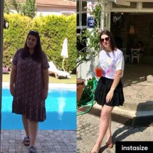 obezite cerrahisi deegisim sanati18