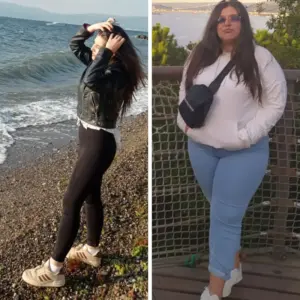 obezite cerrahisi deegisim sanati2