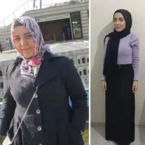 obezite cerrahisi deegisim sanati20