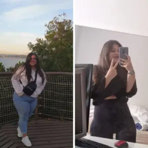 obezite cerrahisi deegisim sanati4