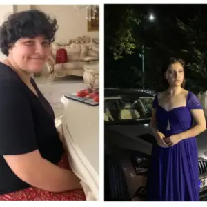 obezite cerrahisi deegisim sanati5